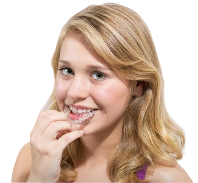 Баннер Установка элайнеров Баннер Установка элайнеров